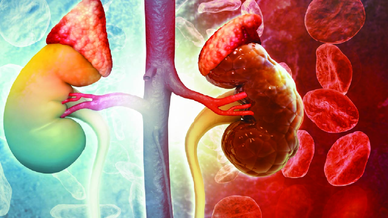 The Kidneys in Health and Disease